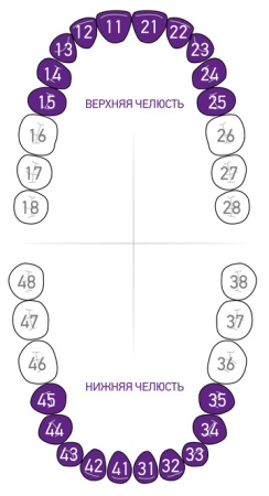 Кламп для коффердама Dentech (Япония) 212 (В6) Кламп для коффердама Dentech (Япония) 212 (В6)